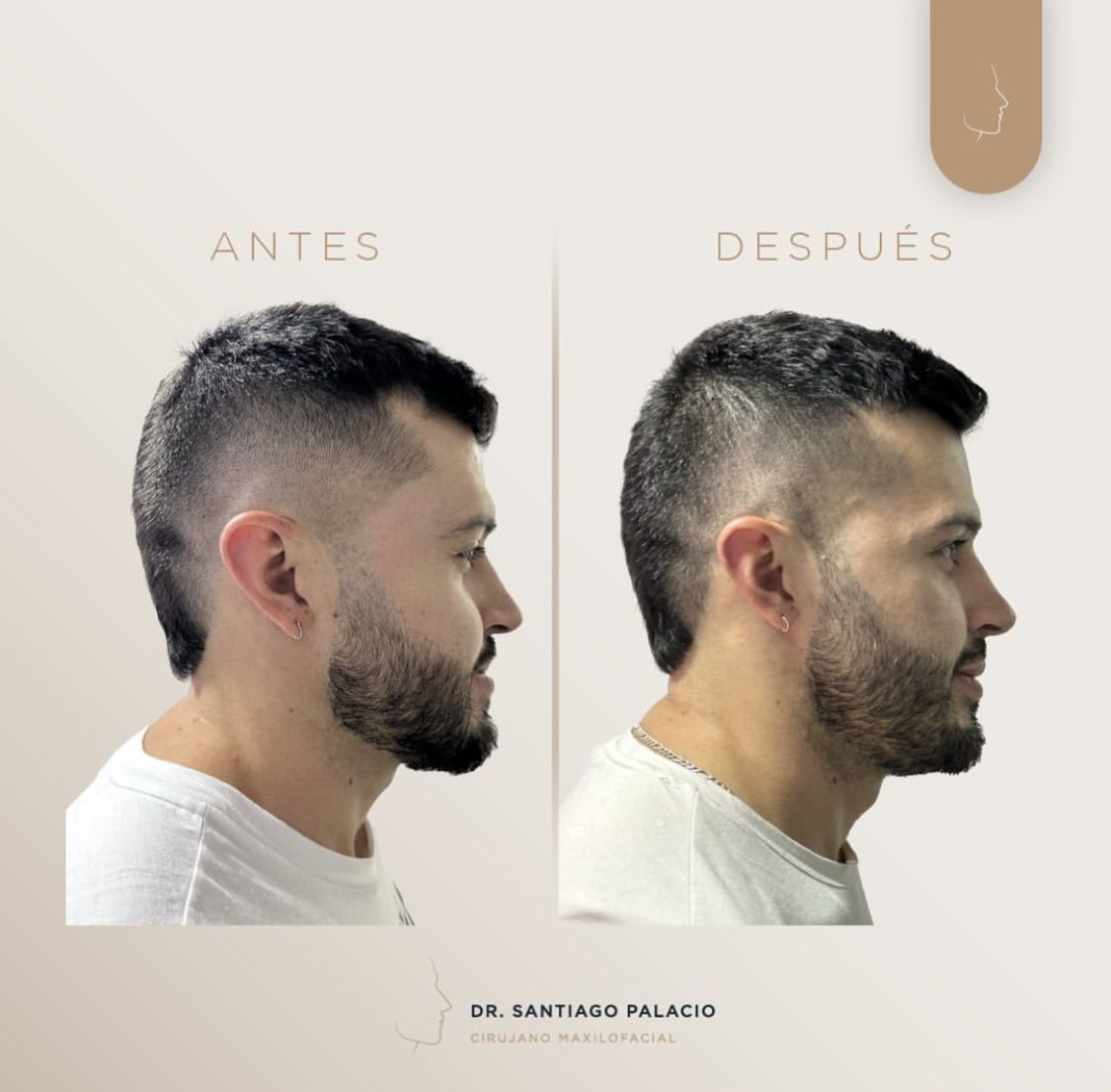 Santiago Palacio Gutierrez-4