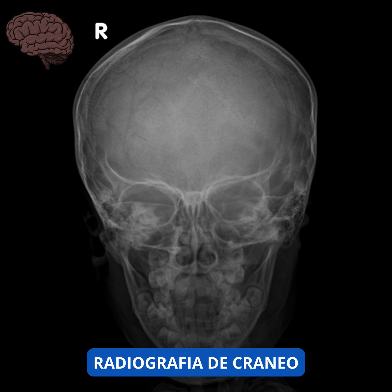 David Tafur Muñoz-1982