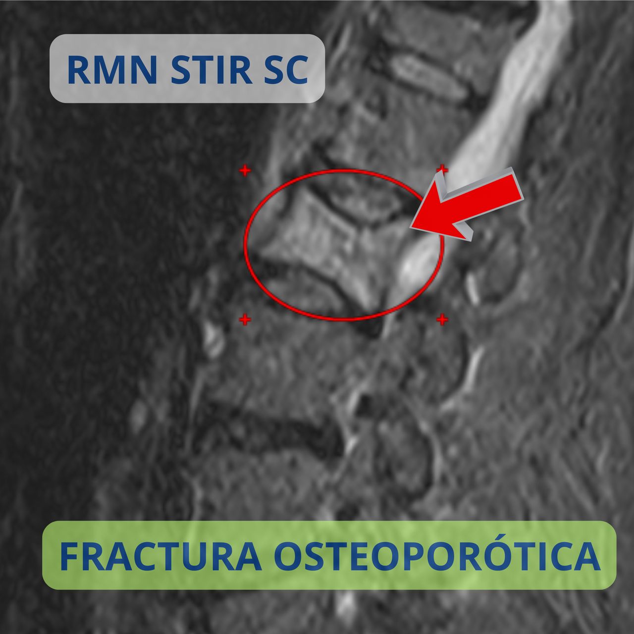 David Tafur Muñoz-2191