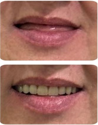 Carlos Andrés Giraldo Muñetón-6