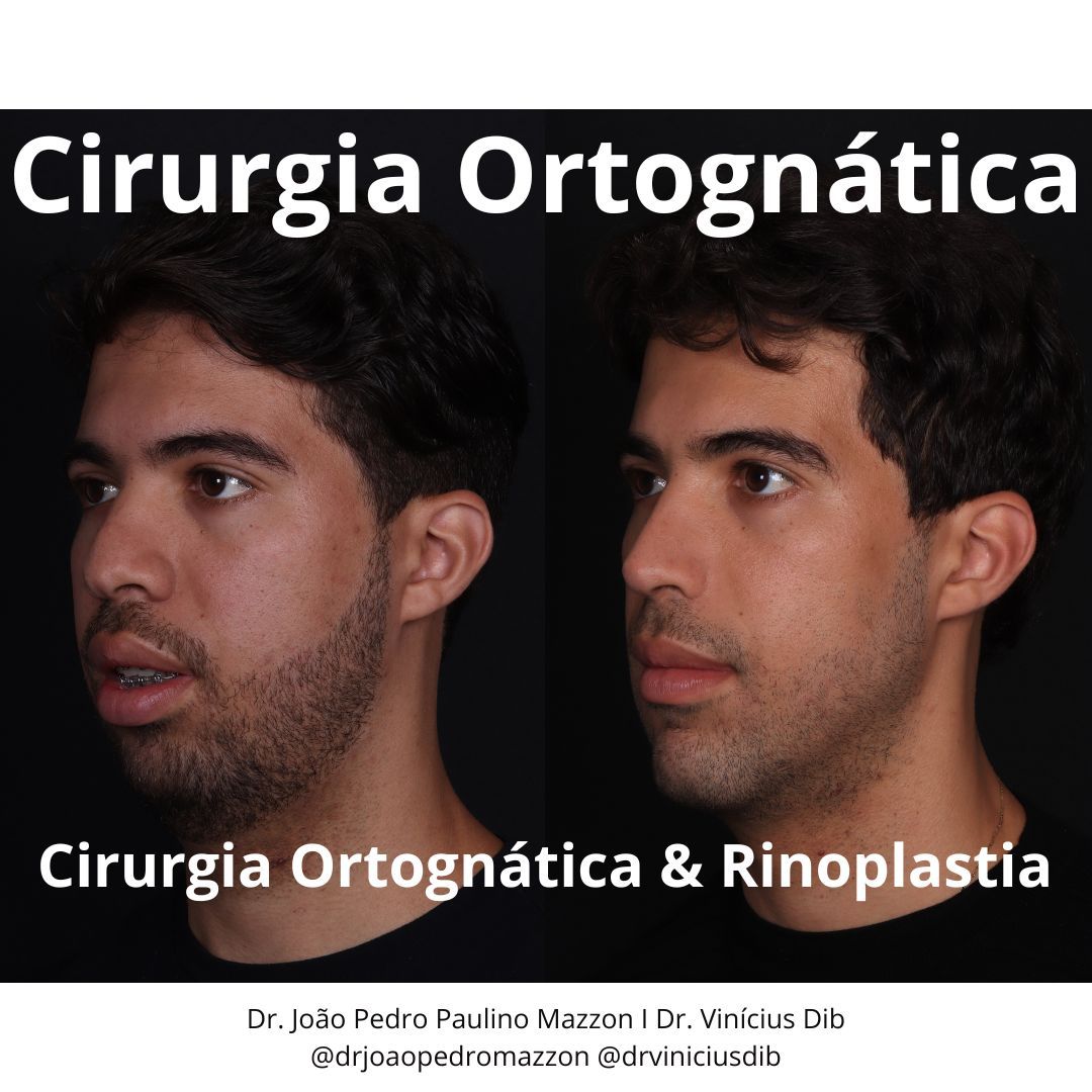 João Pedro Paulino Mazzon-41