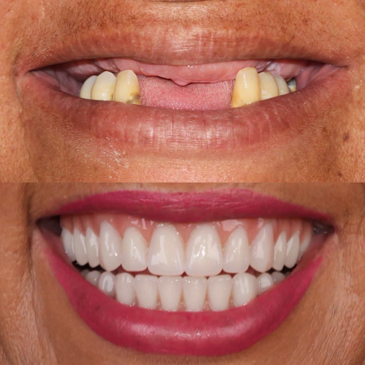 Caroline Benedeti-36