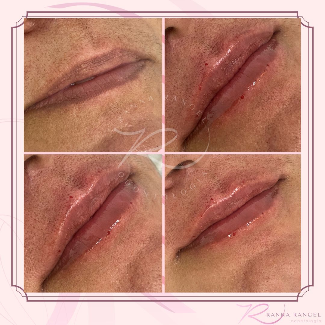 Ranna Rangel Saraiva-5