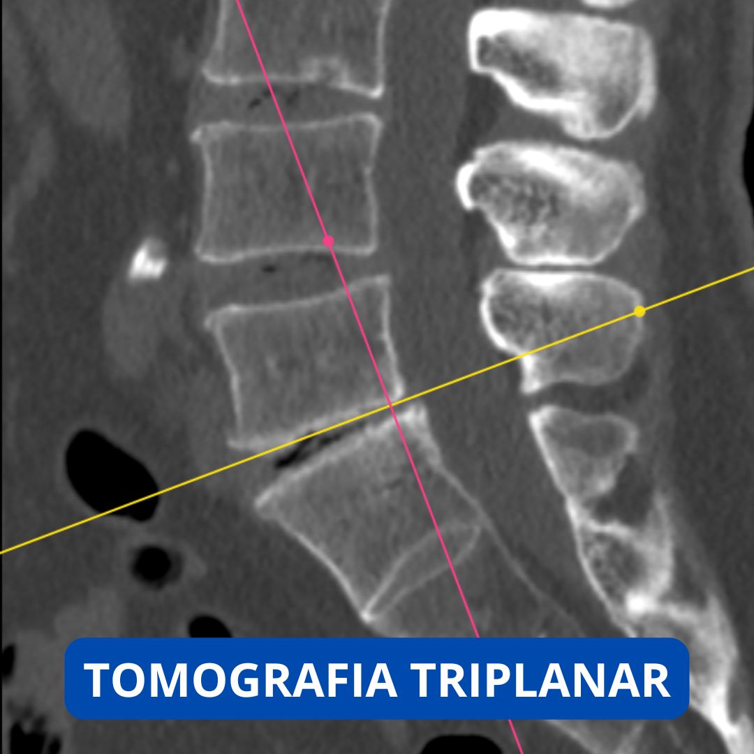 David Tafur Muñoz-2314