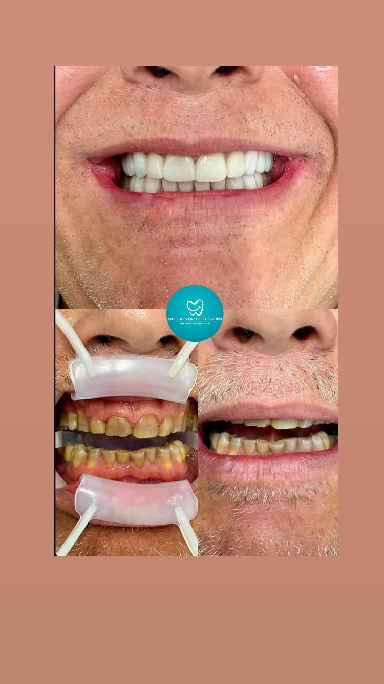 Osman Fernando Holguin Grisales-21