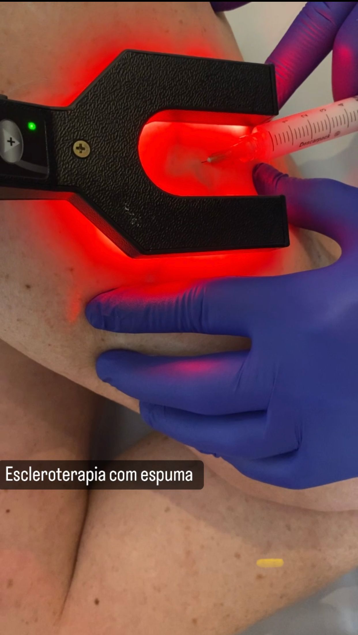 Marcos Felipe Magalhaes De Sá-10