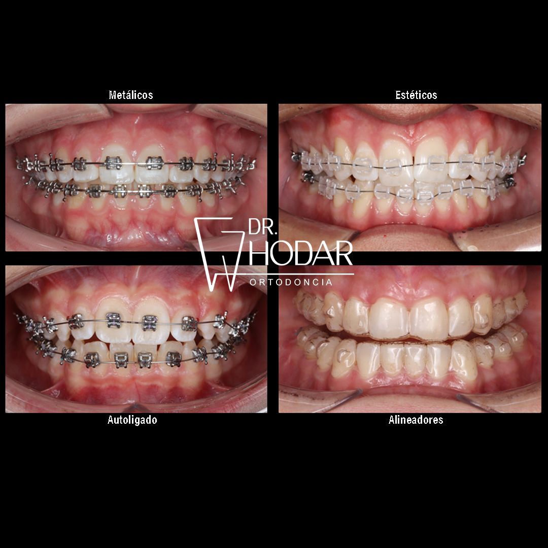 Rodrigo Hodar Dinamarca-7