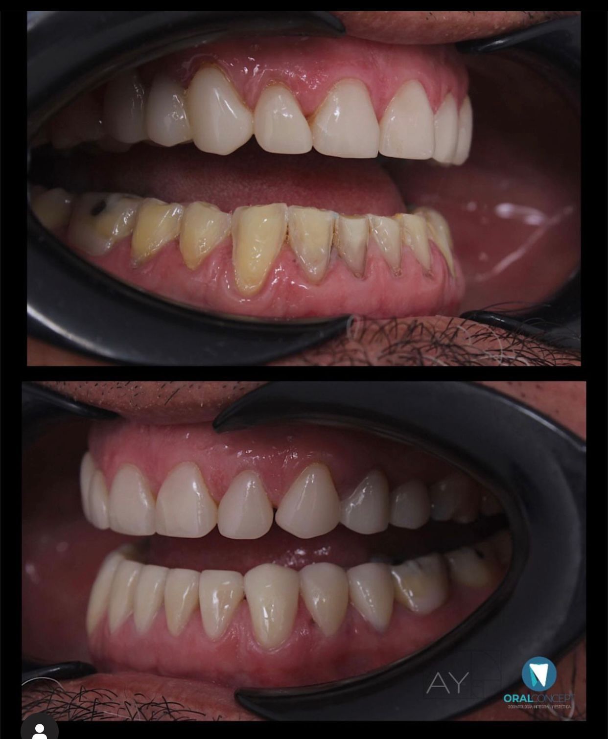 Andrés Mauricio Yepes Vargas-3