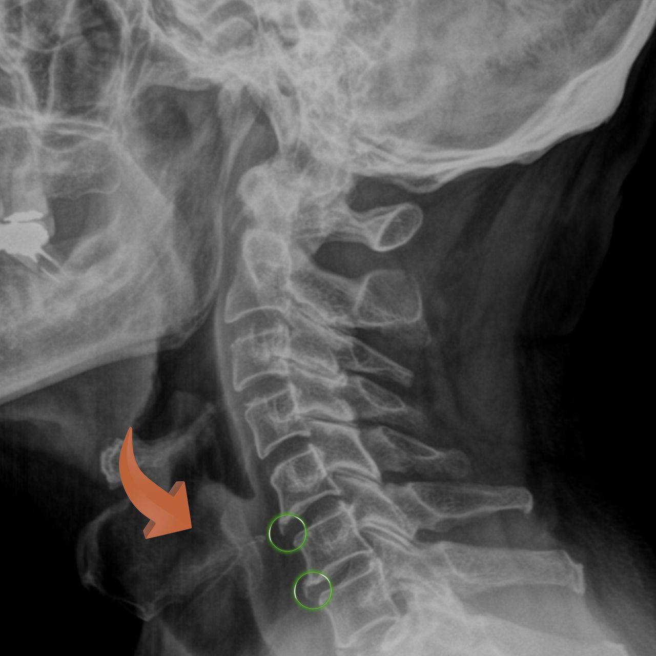 David Tafur Muñoz-1472