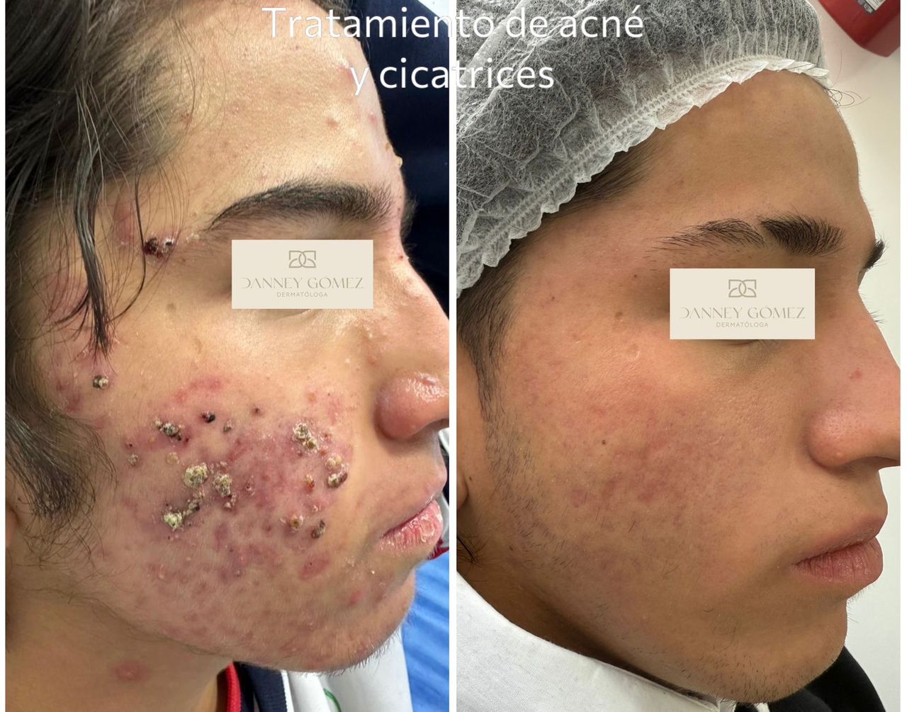 Danney Gomez Angulo-5