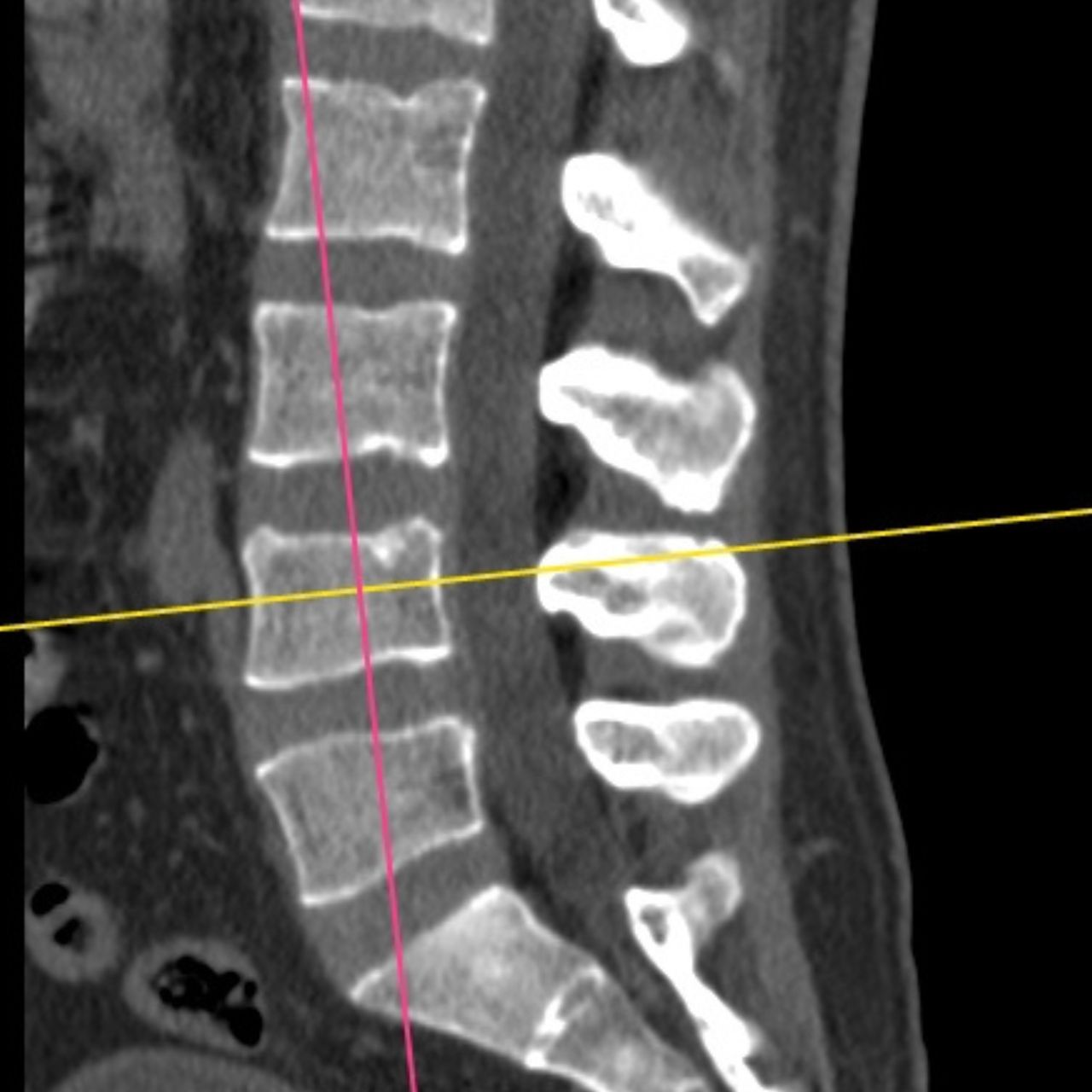David Tafur Muñoz-1491
