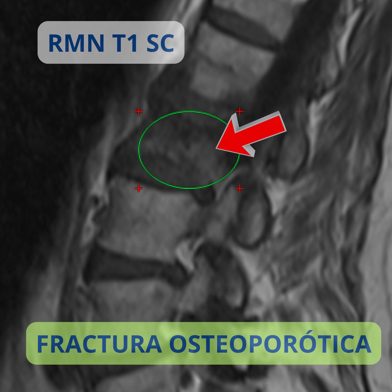 David Tafur Muñoz-2238