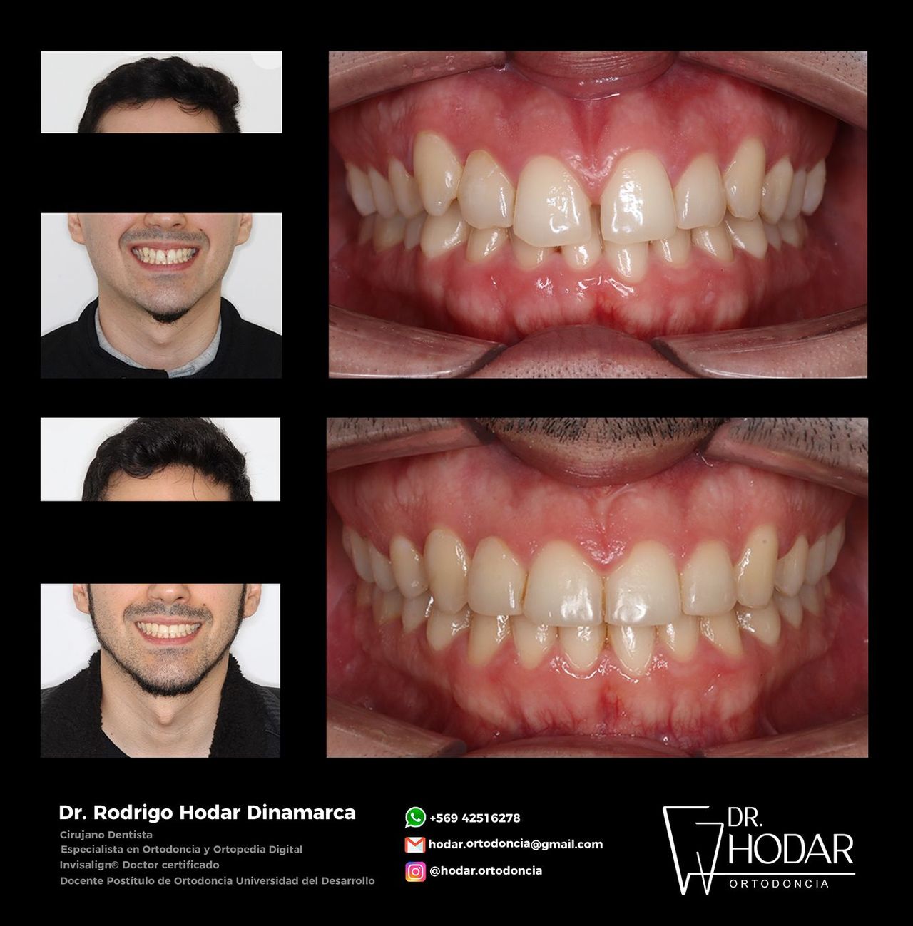 Rodrigo Hodar Dinamarca-3