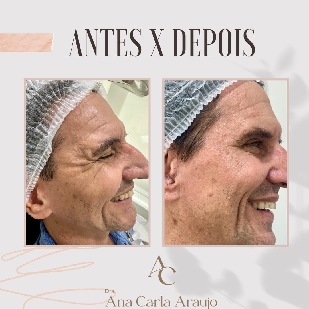 Ana Carla Rocha De Araujo-3