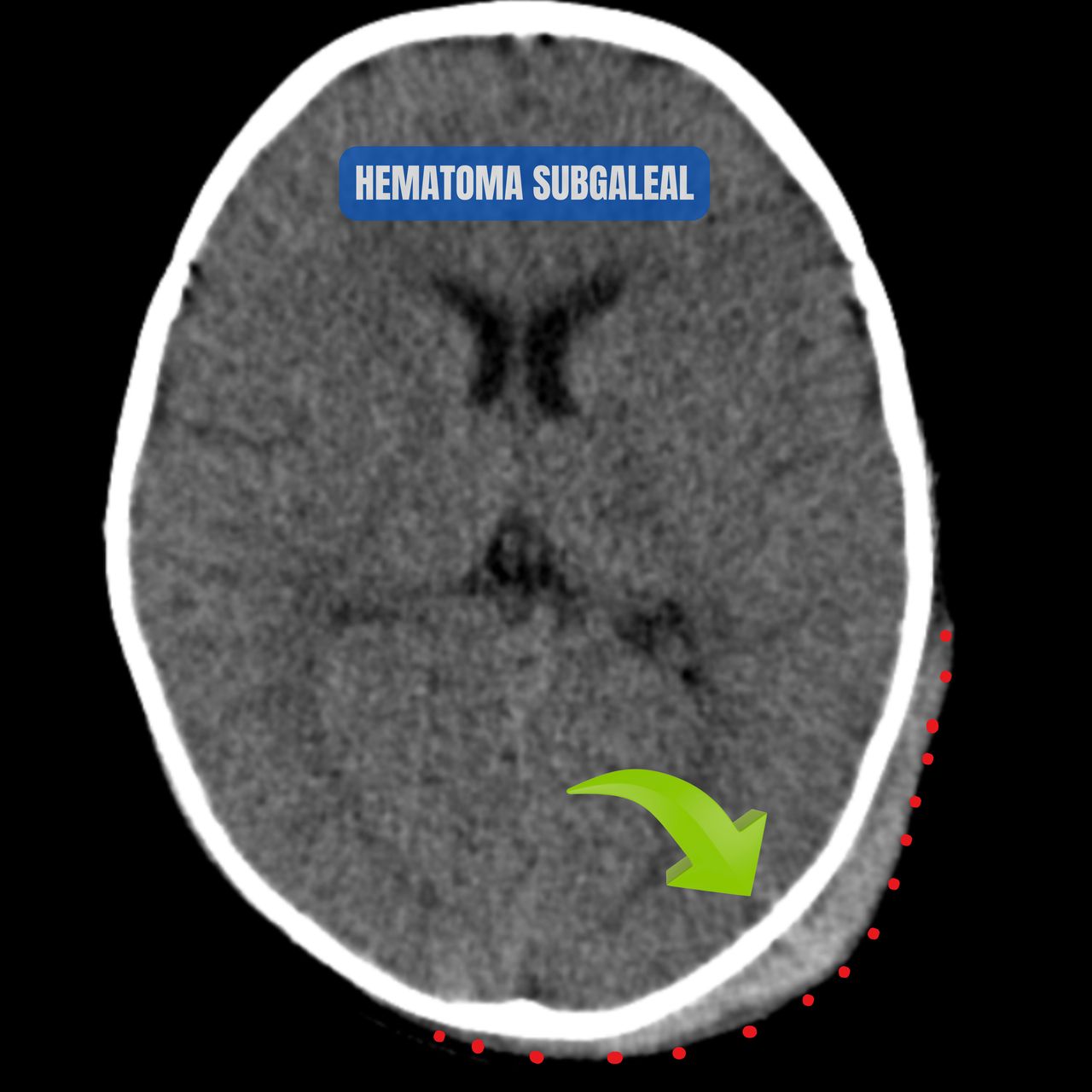 David Tafur Muñoz-1820