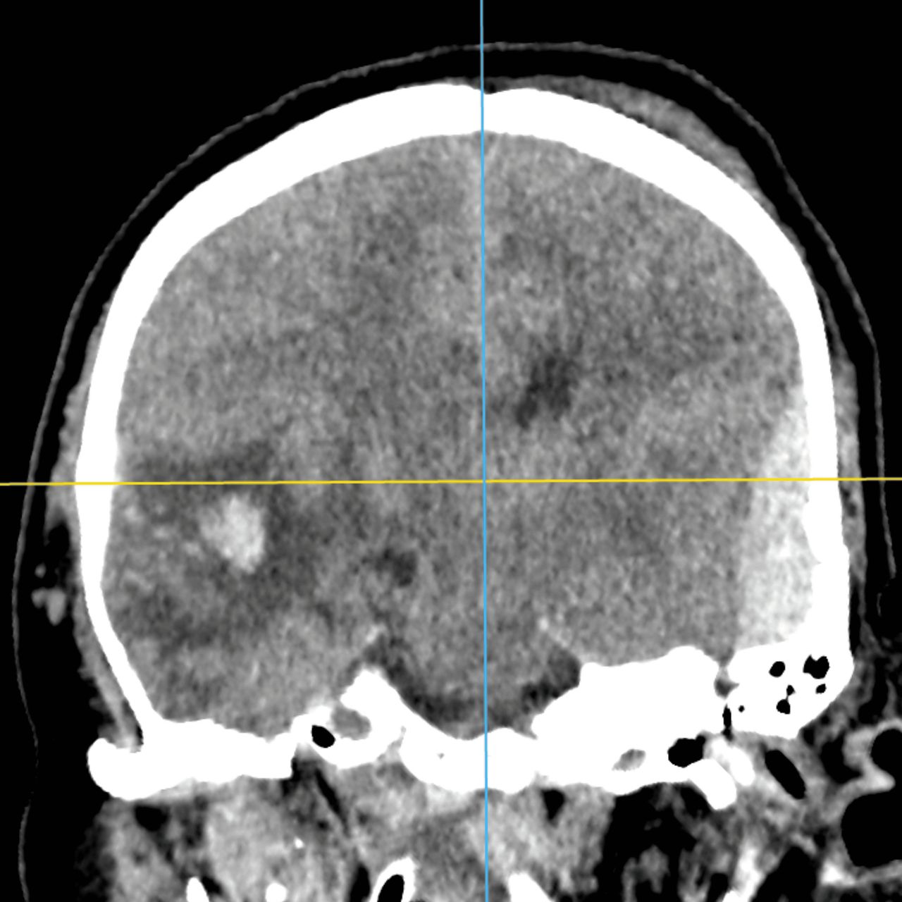 David Tafur Muñoz-2351