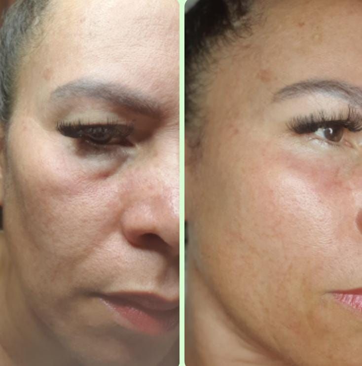 Anizia Cassiano Neves .-6