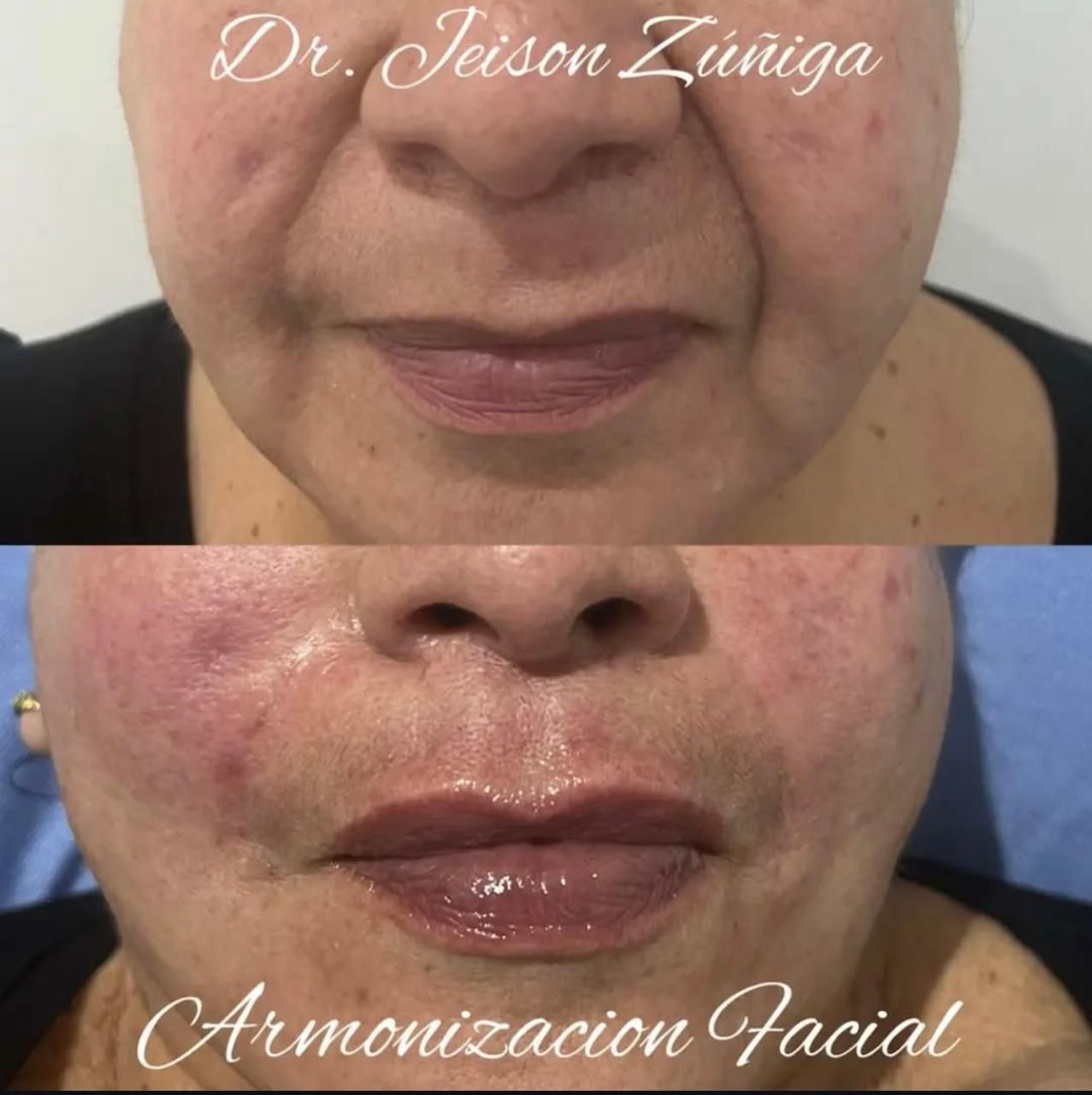 Jeison De Jesus Zuñiga Lara-3