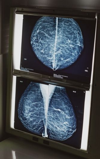 Elis Regina Charello-7