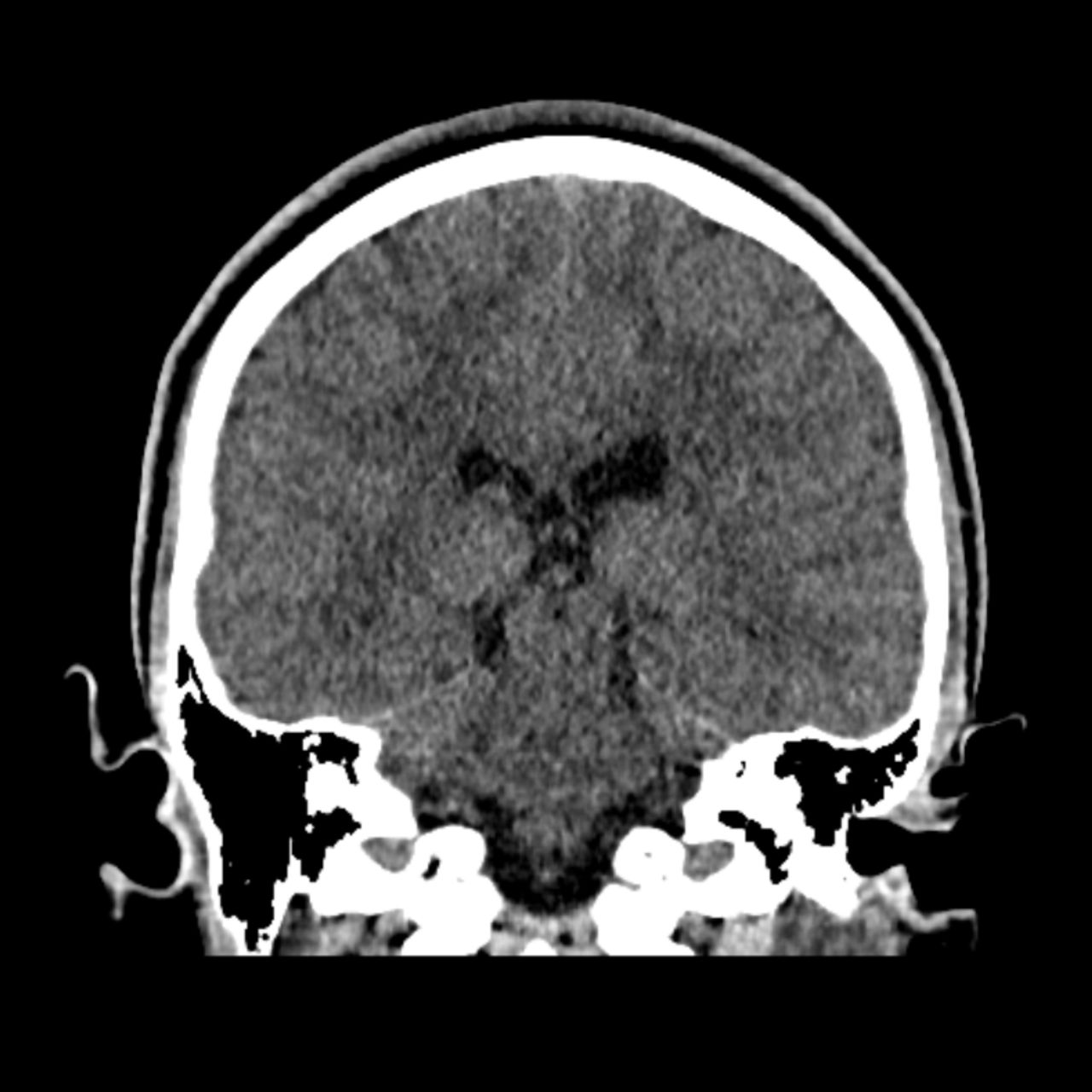 David Tafur Muñoz-1124