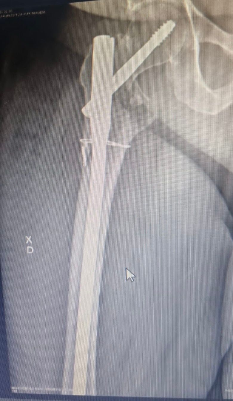 João Mauro Mendina De Morais-7
