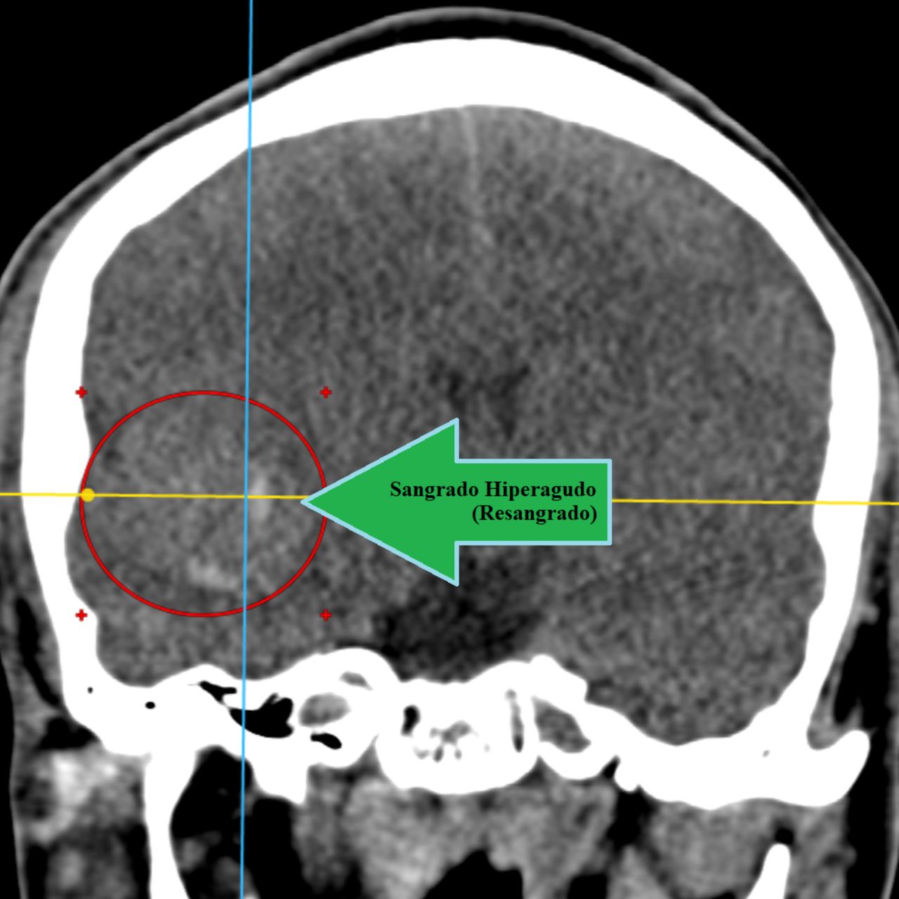 David Tafur Muñoz-1584