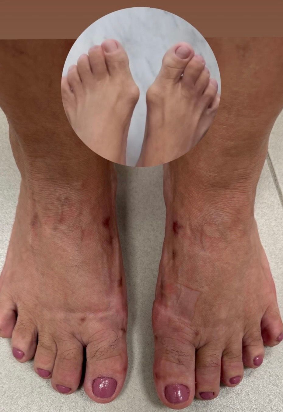 Leandro Jacomassi Machado-13