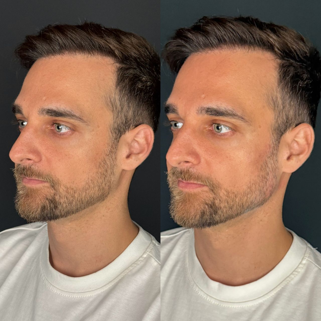 Caroline Benedeti-45