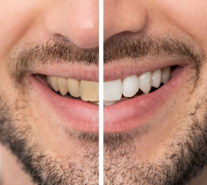 Juan Carlos Arango Marin-3