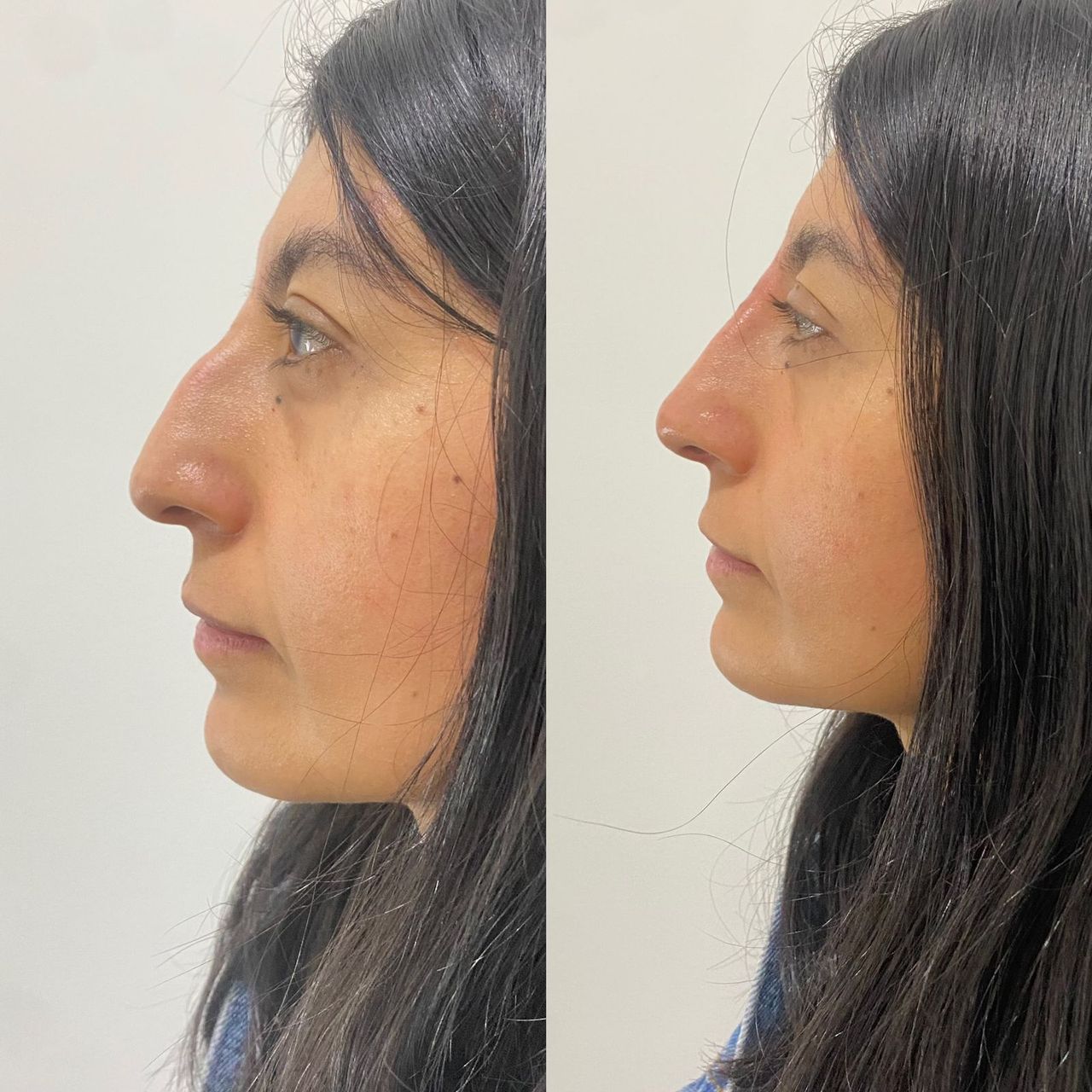 Oscar Iván Lozano Navarrete-26