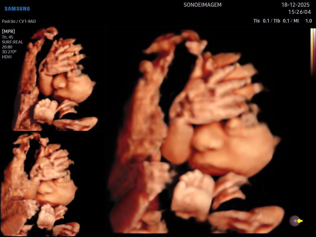 Gontran Tôrres Fróes-3