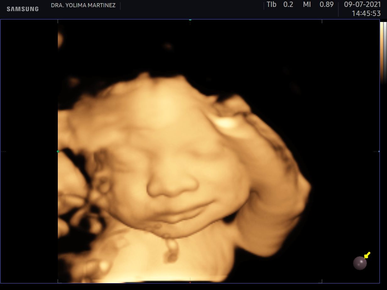 Mercy Yolima Martínez Velásquez-5