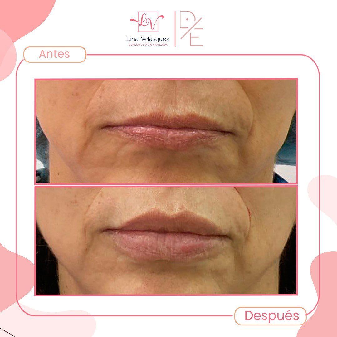 Lina Velásquez Tafur-14