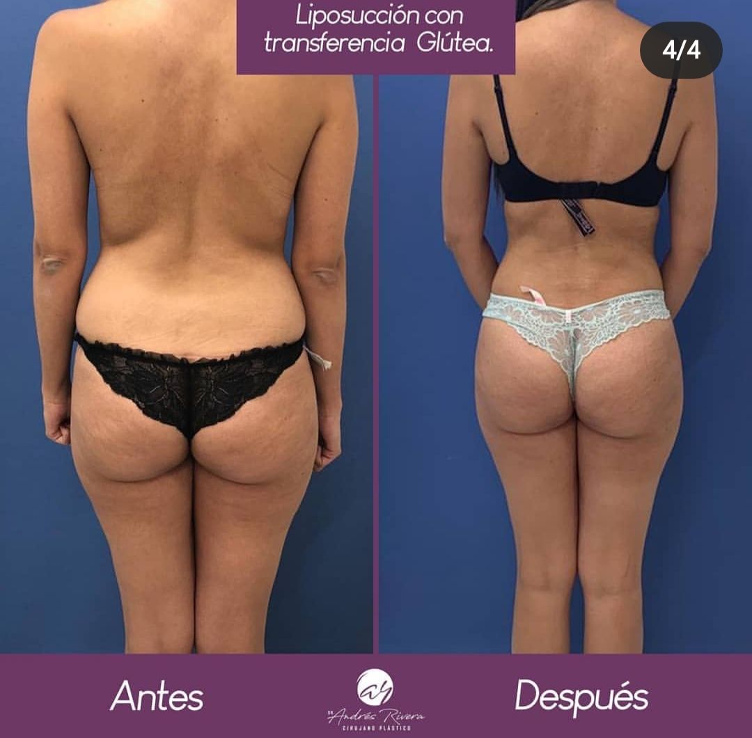 Andrés Rivera López-37