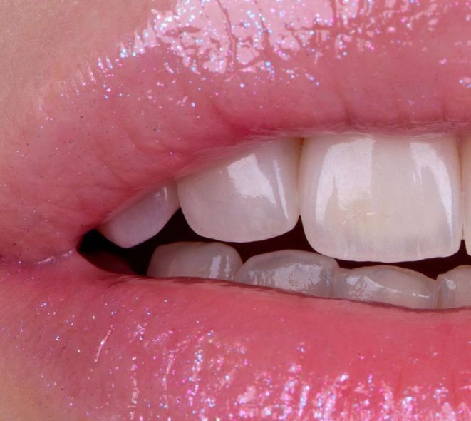 Mauricio Arias Merino-8