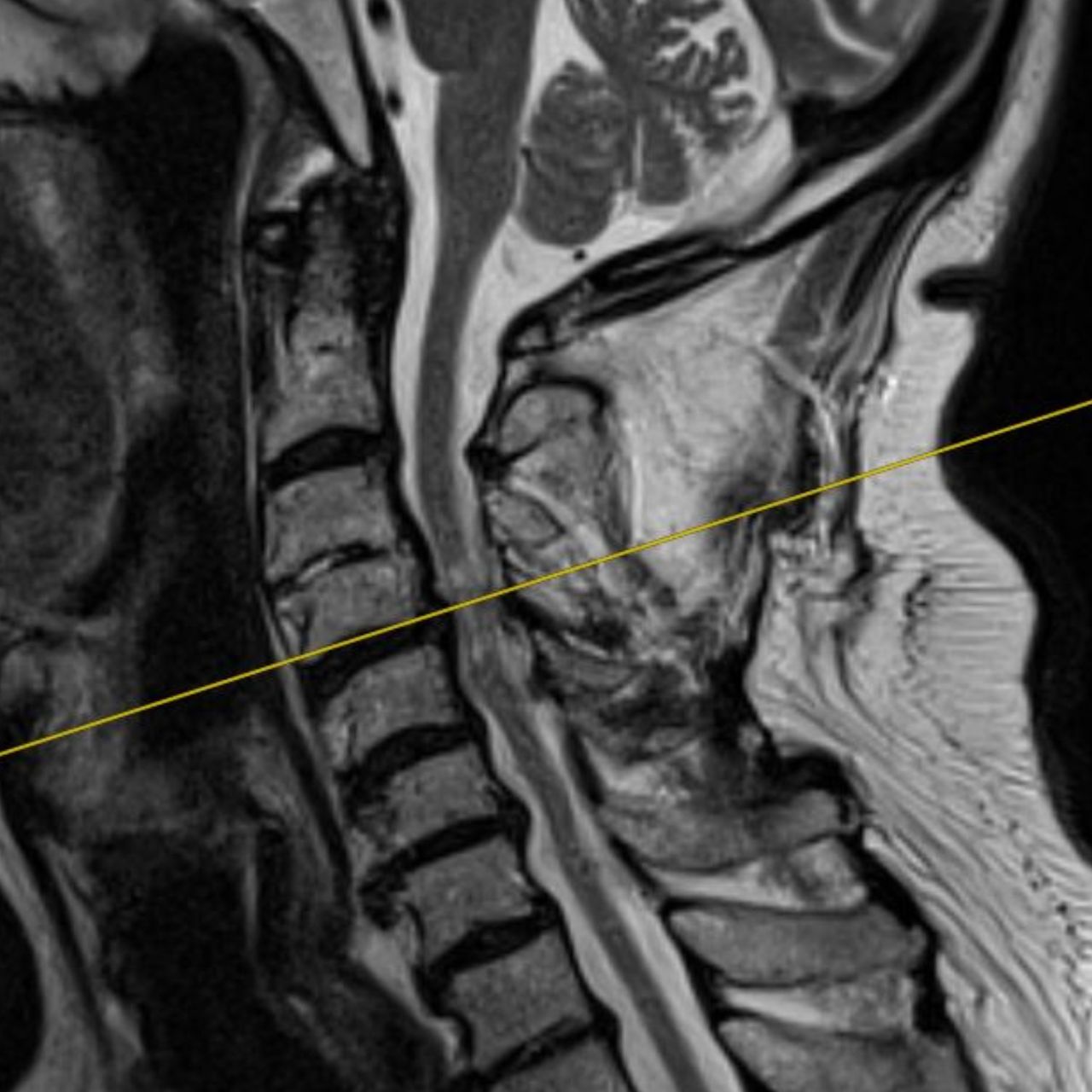 David Tafur Muñoz-1346