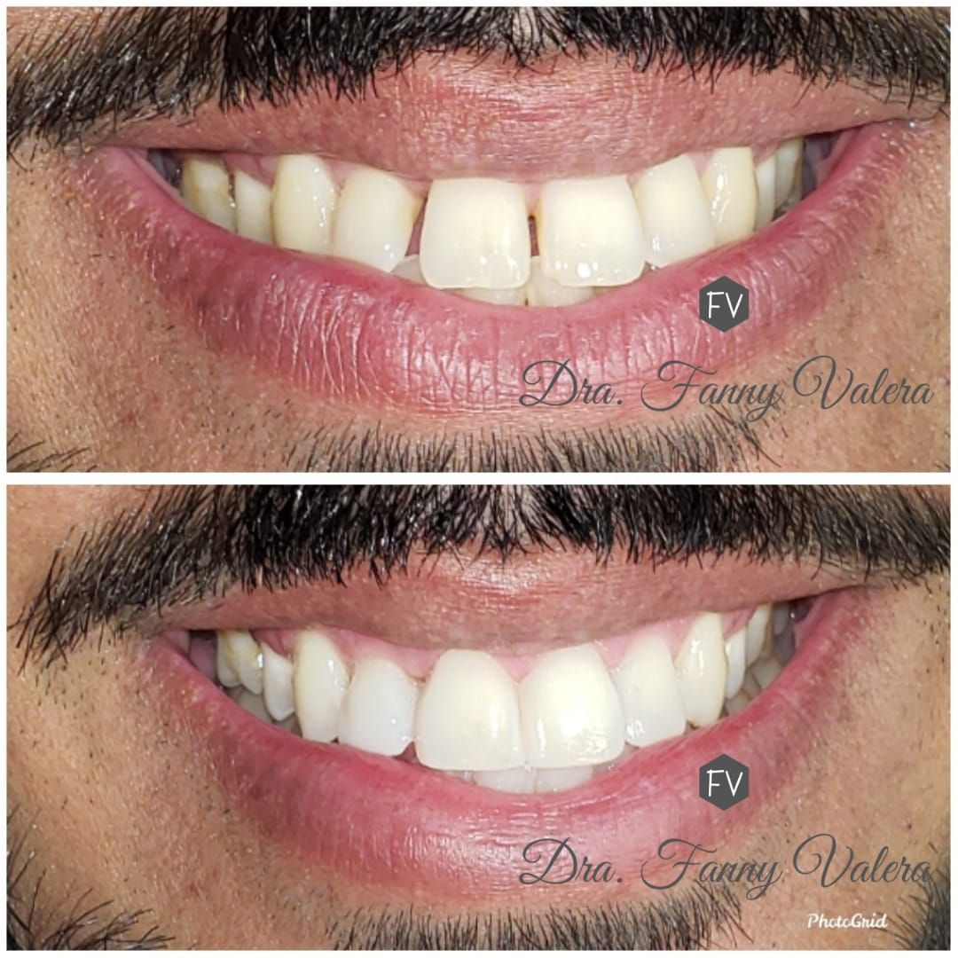 Fanny Valera Velásquez-83