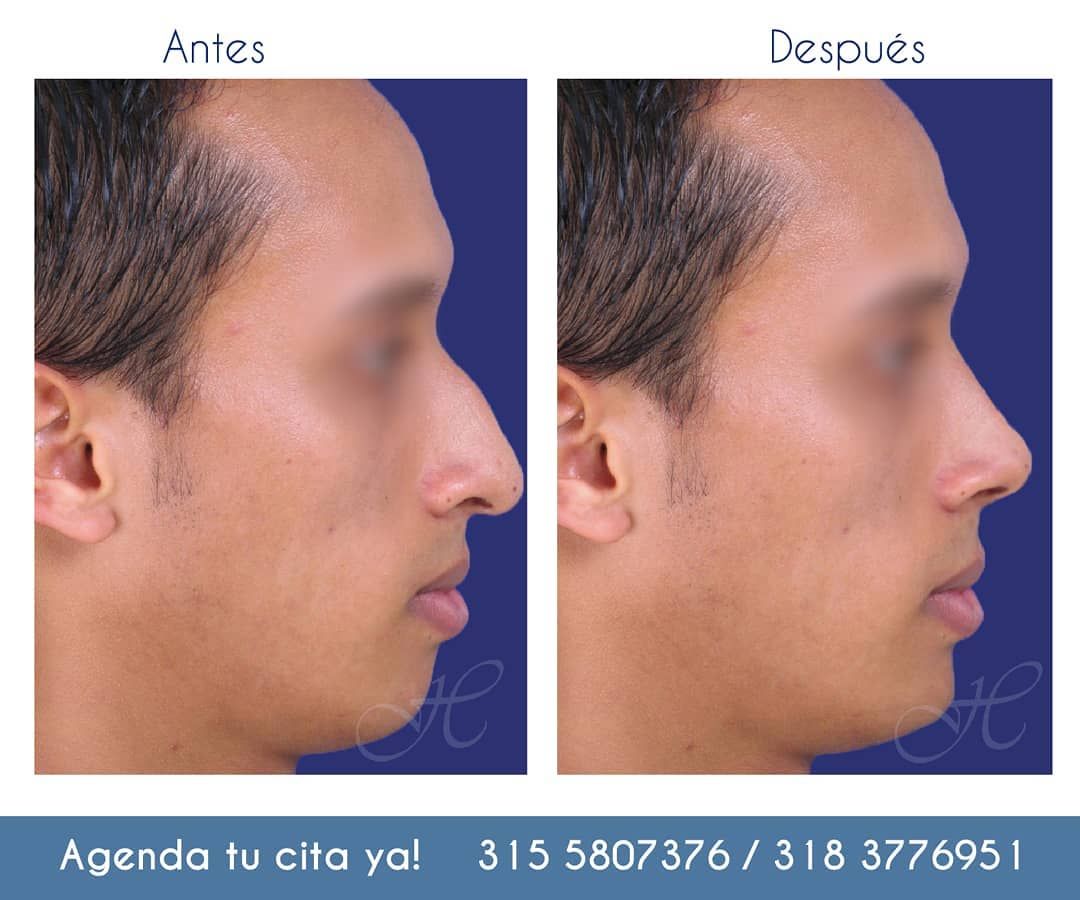 Jorge A Holguin Ruiz-46