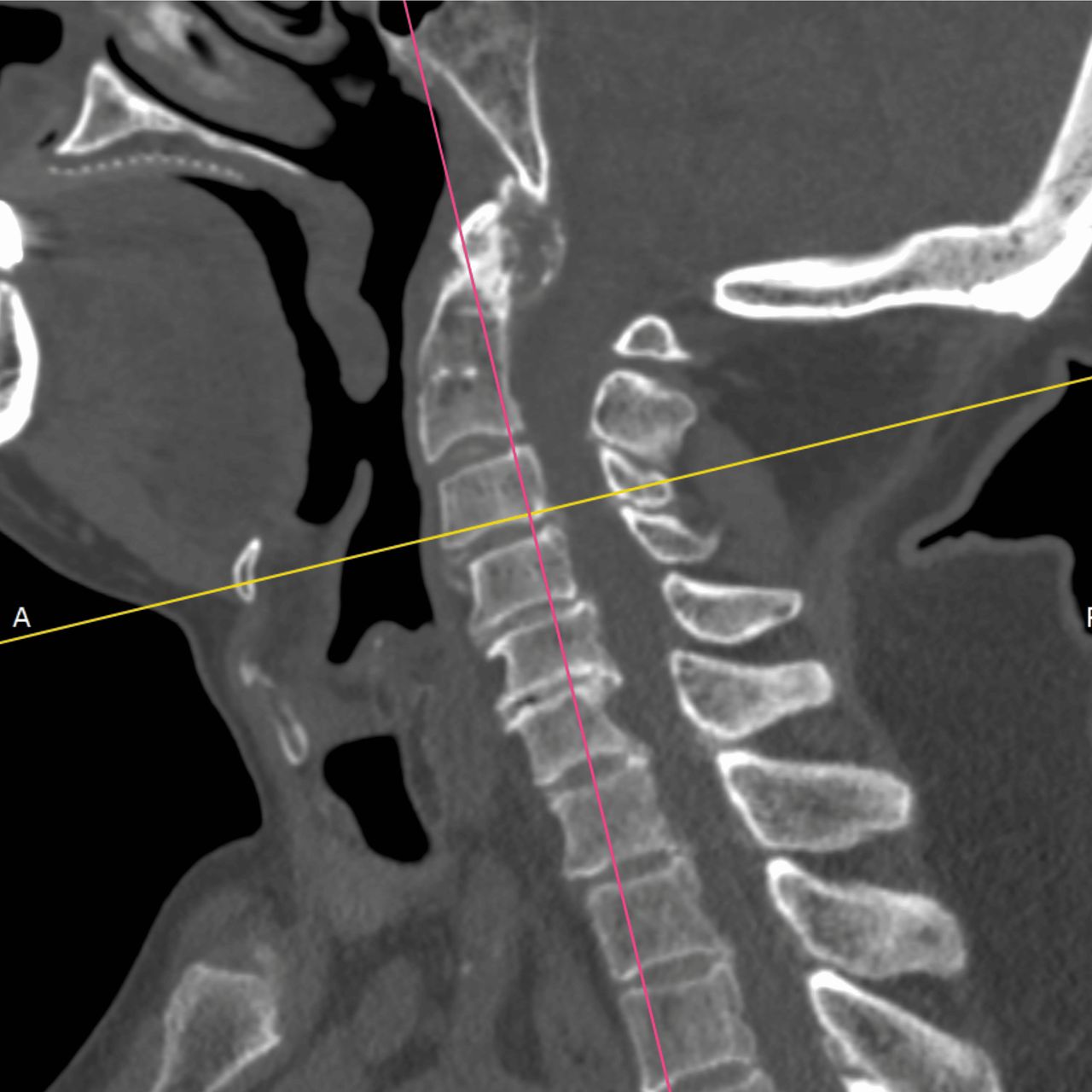 David Tafur Muñoz-2342