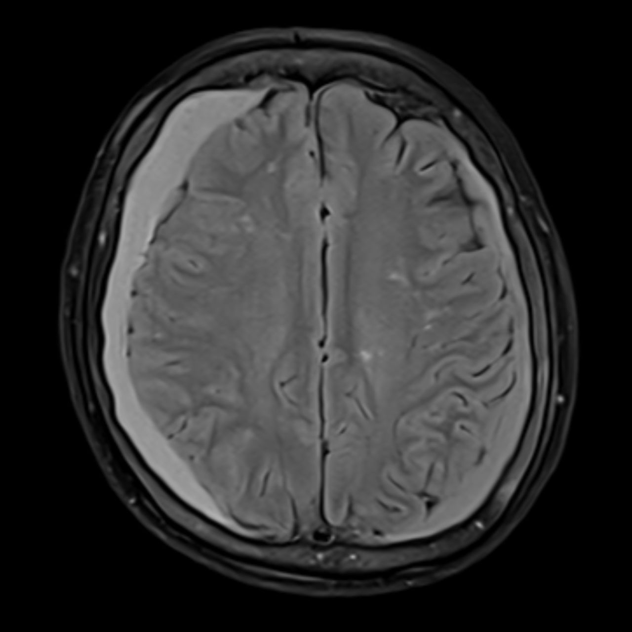 David Tafur Muñoz-2138