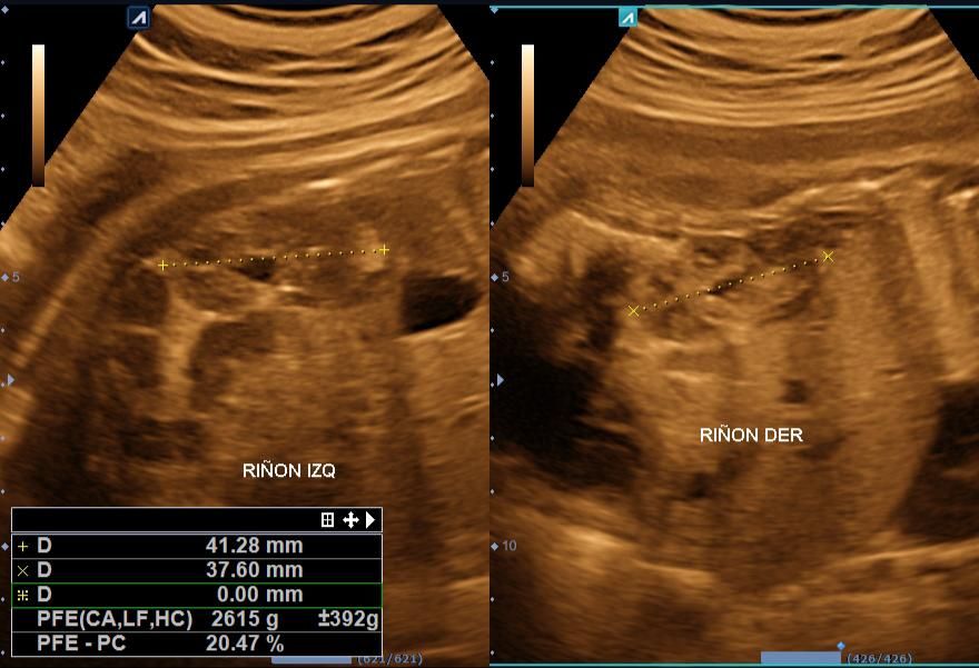 Benjamín Villarroel Castillo-8