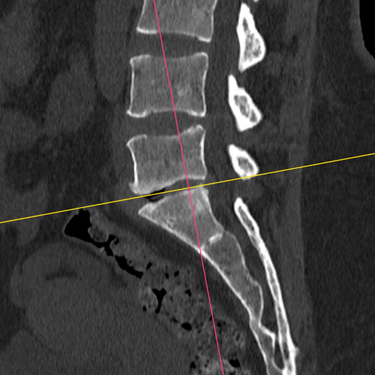 David Tafur Muñoz-2456