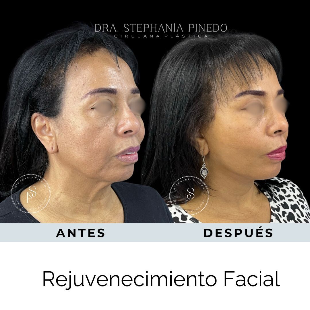 Stephanía Pinedo García-2