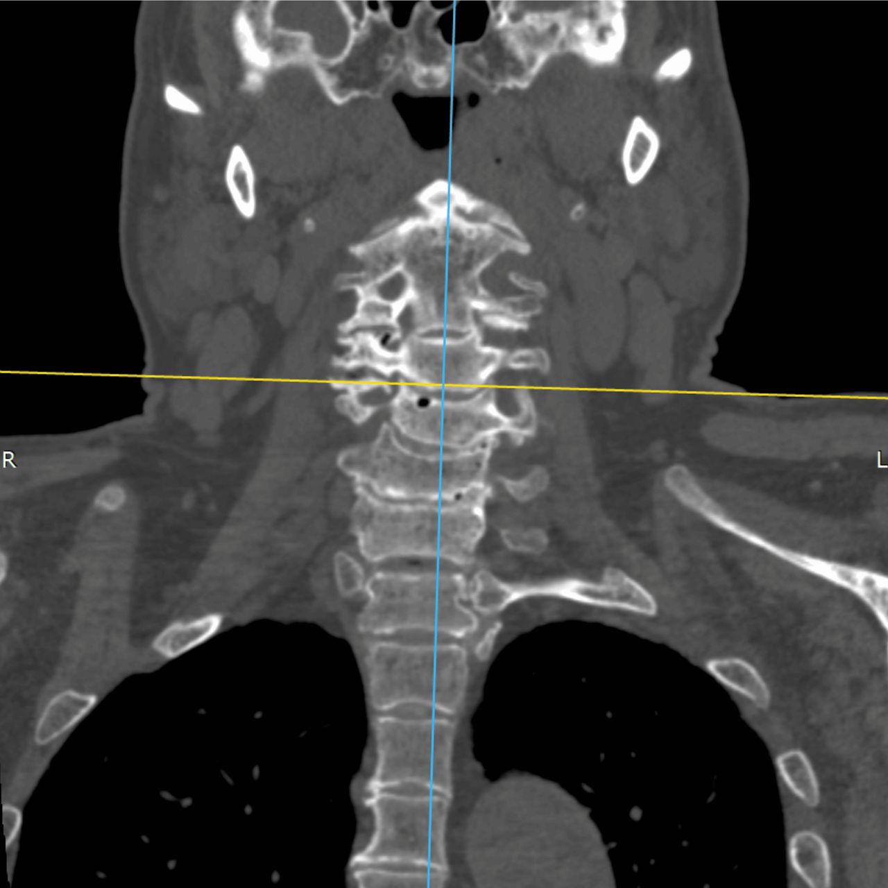 David Tafur Muñoz-2343