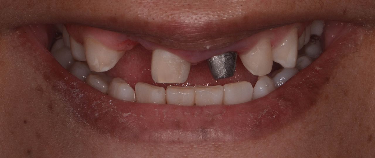 Edith Molina Miranda-11