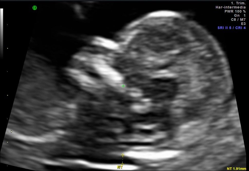 Mercy Yolima Martínez Velásquez-11