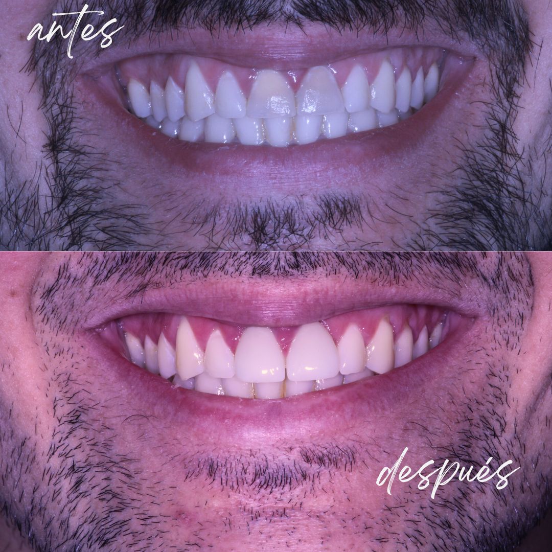 Nicolás Gallardo-15