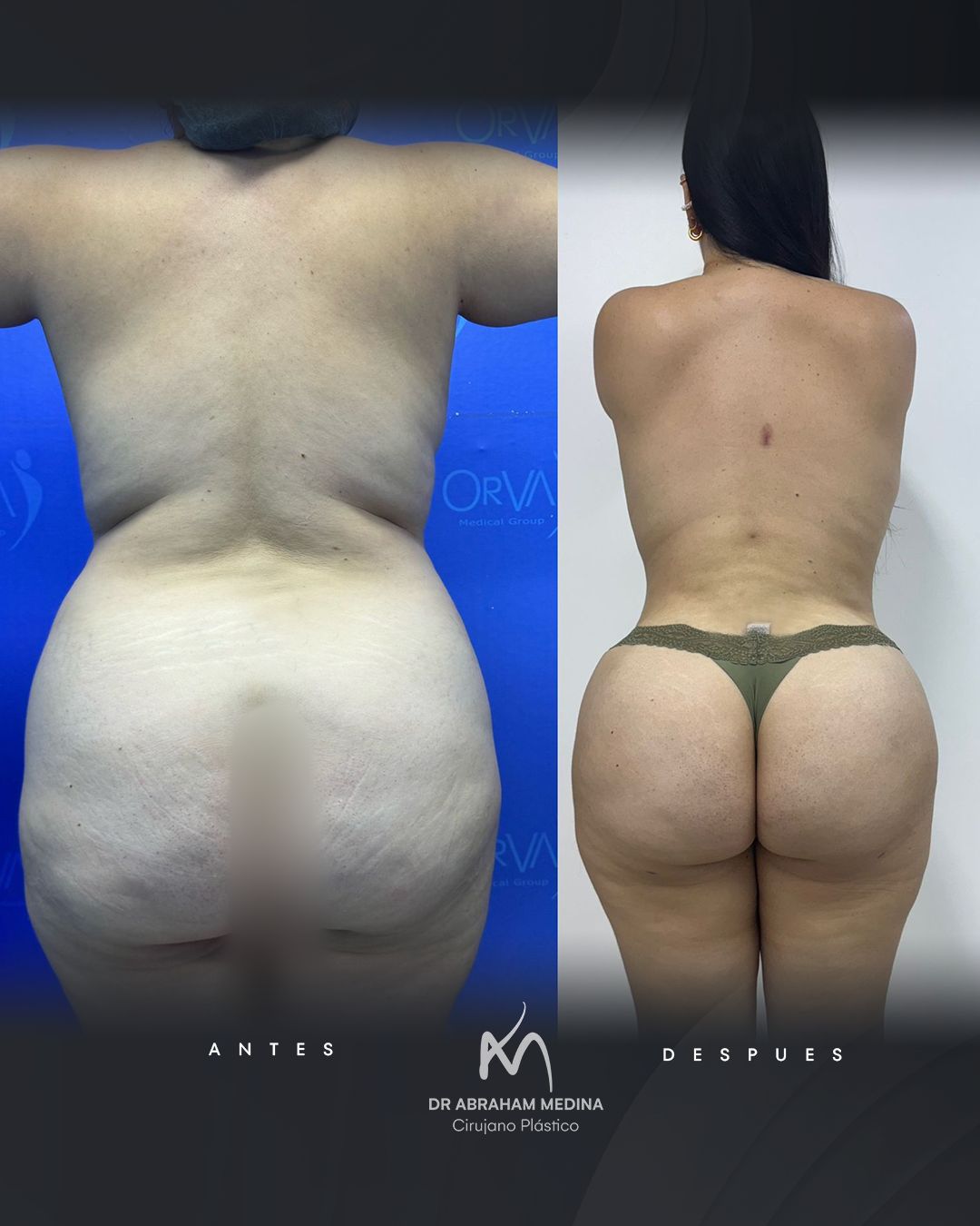 Jose Abraham Medina Y Navarro-3