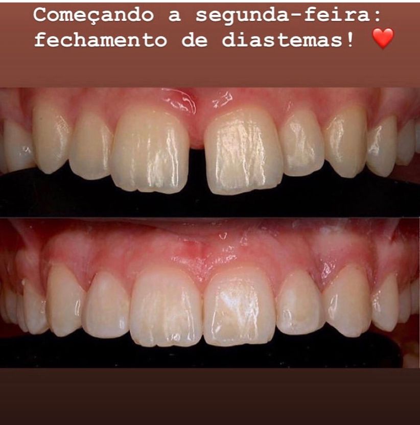 Leandro Ponte Dias-38