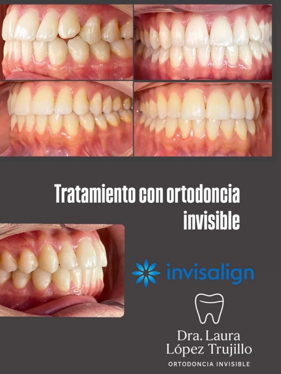 Laura Victoria López Trujillo-8